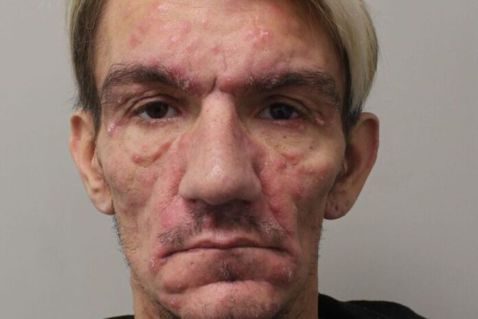 Royaume-Uni : la police recherche jusqu’à 400 victimes d’un prédateur sexuel porteur du VIH