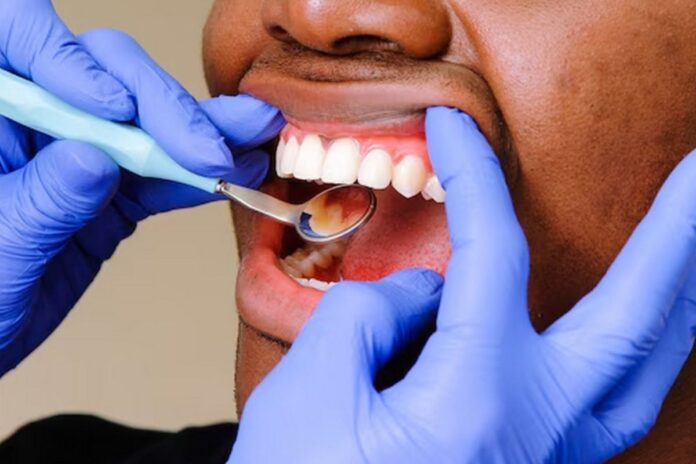 Santé bucco-dentaire : un miroir fidèle de notre état de santé