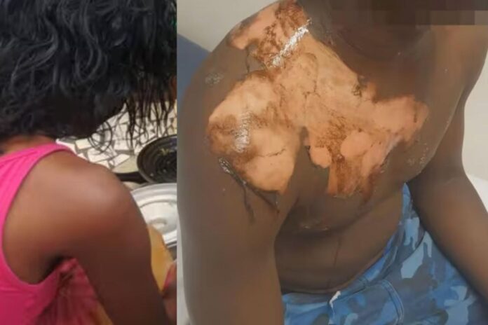 Sénégal : une femme ébouillante son mari pour l’empêcher de prendre une seconde épouse