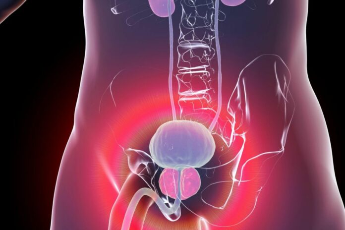 Cancer de la prostate : ce que les études disent de l’impact d’une activité sexuelle régulière