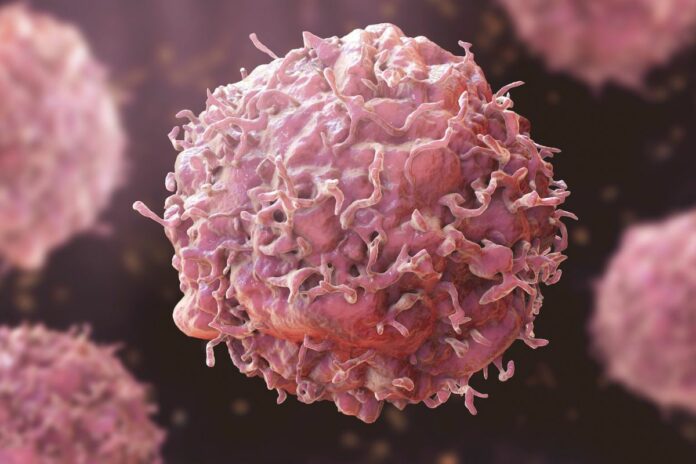 Santé : la science fait un grand pas dans la lutte contre le cancer