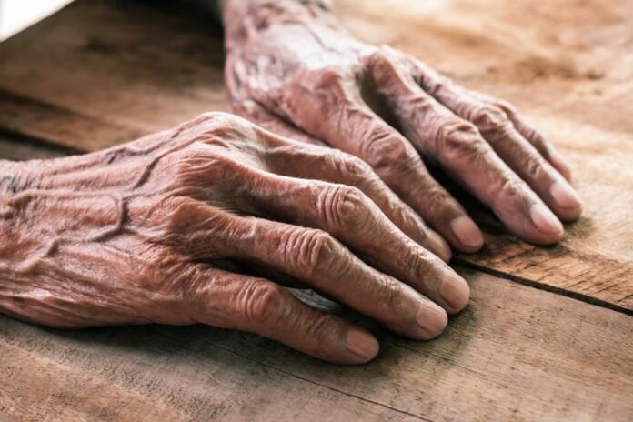 , espérance de vie,