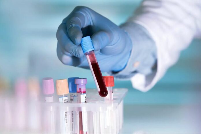 Côte d'Ivoire : un laboratoire public d'analyses ADN opérationnel Côte d'Ivoire analyses ADN