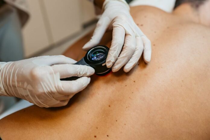 un tatouage capable de repérer un cancer de la peau avant qu’il ne soit visible
