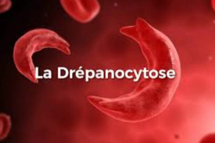 Bénin campagne dépistage drépanocytose