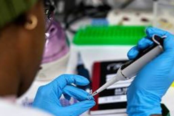 Togo : les biologistes médicaux sonnent l’alerte sur la préparation aux épidémies