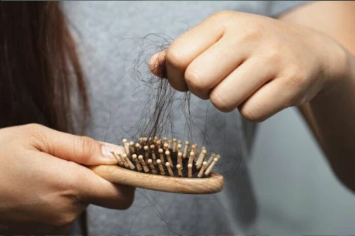 Chute de cheveux : les compléments alimentaires ont-ils une réelle efficacité ? Chute de cheveux : les compléments alimentaires ont-ils une réelle efficacité ?